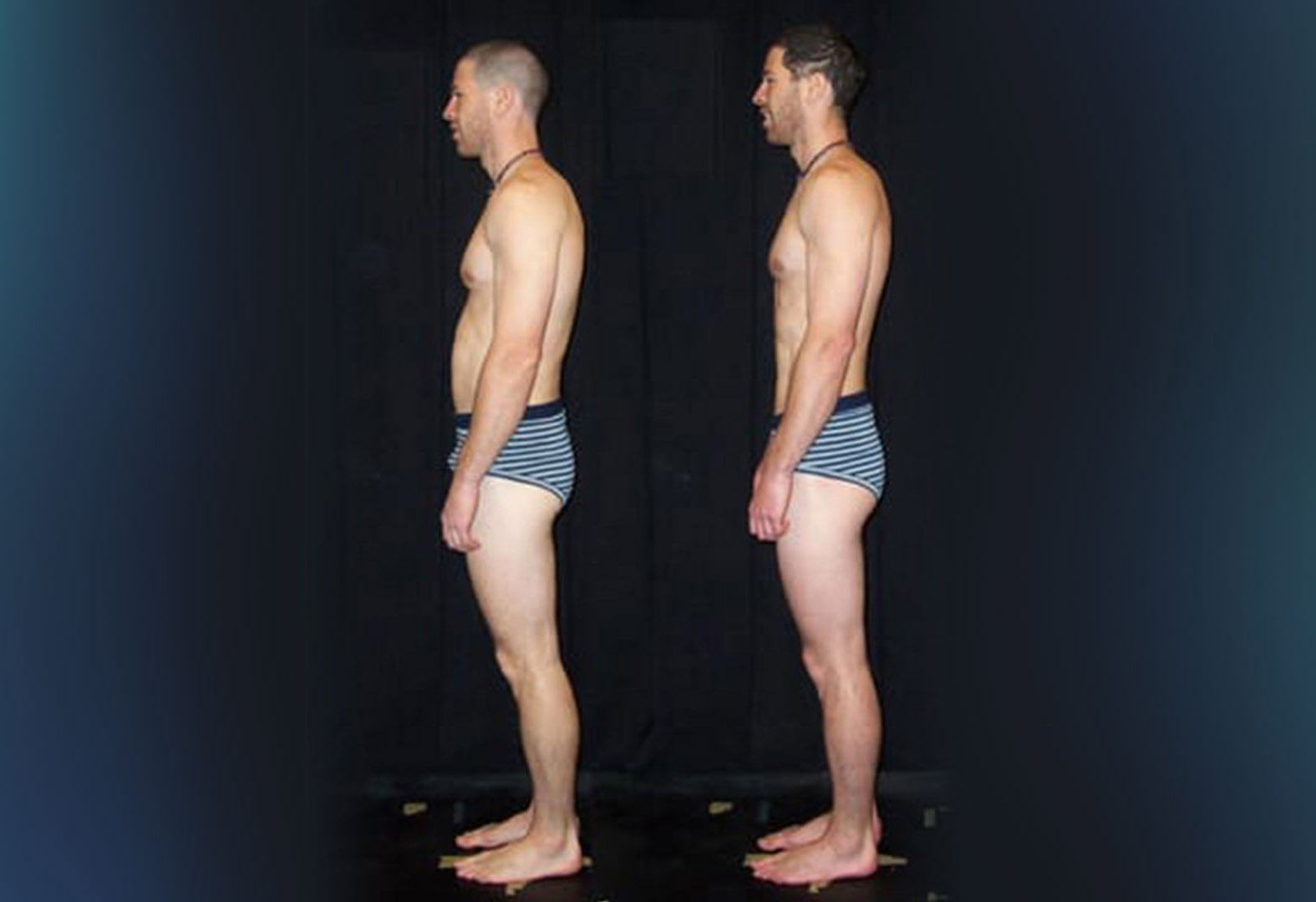 Before and after ten sessions using the Rolfing structural integration technique